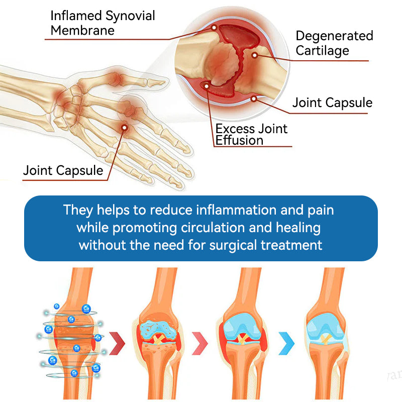 𝐀𝐞𝐞𝒉𝒇𝗲𝗻𝗴® 𝐁𝐏𝐂-𝟏𝟓𝟕 𝐉𝐨𝐢𝐧𝐭 𝐇𝐞𝐚𝐥𝐢𝐧𝐠 𝐂𝐫𝐞𝐚𝐦
