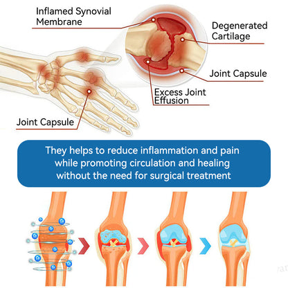 𝐀𝐞𝐞𝒉𝒇𝗲𝗻𝗴® 𝐁𝐏𝐂-𝟏𝟓𝟕 𝐉𝐨𝐢𝐧𝐭 𝐇𝐞𝐚𝐥𝐢𝐧𝐠 𝐂𝐫𝐞𝐚𝐦