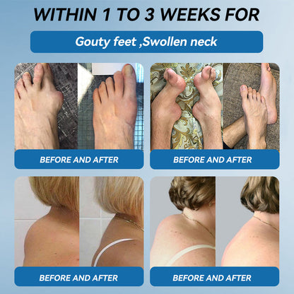 𝐀𝐞𝐞𝒉𝒇𝗲𝗻𝗴® 𝐁𝐏𝐂-𝟏𝟓𝟕 𝐉𝐨𝐢𝐧𝐭 𝐇𝐞𝐚𝐥𝐢𝐧𝐠 𝐂𝐫𝐞𝐚𝐦